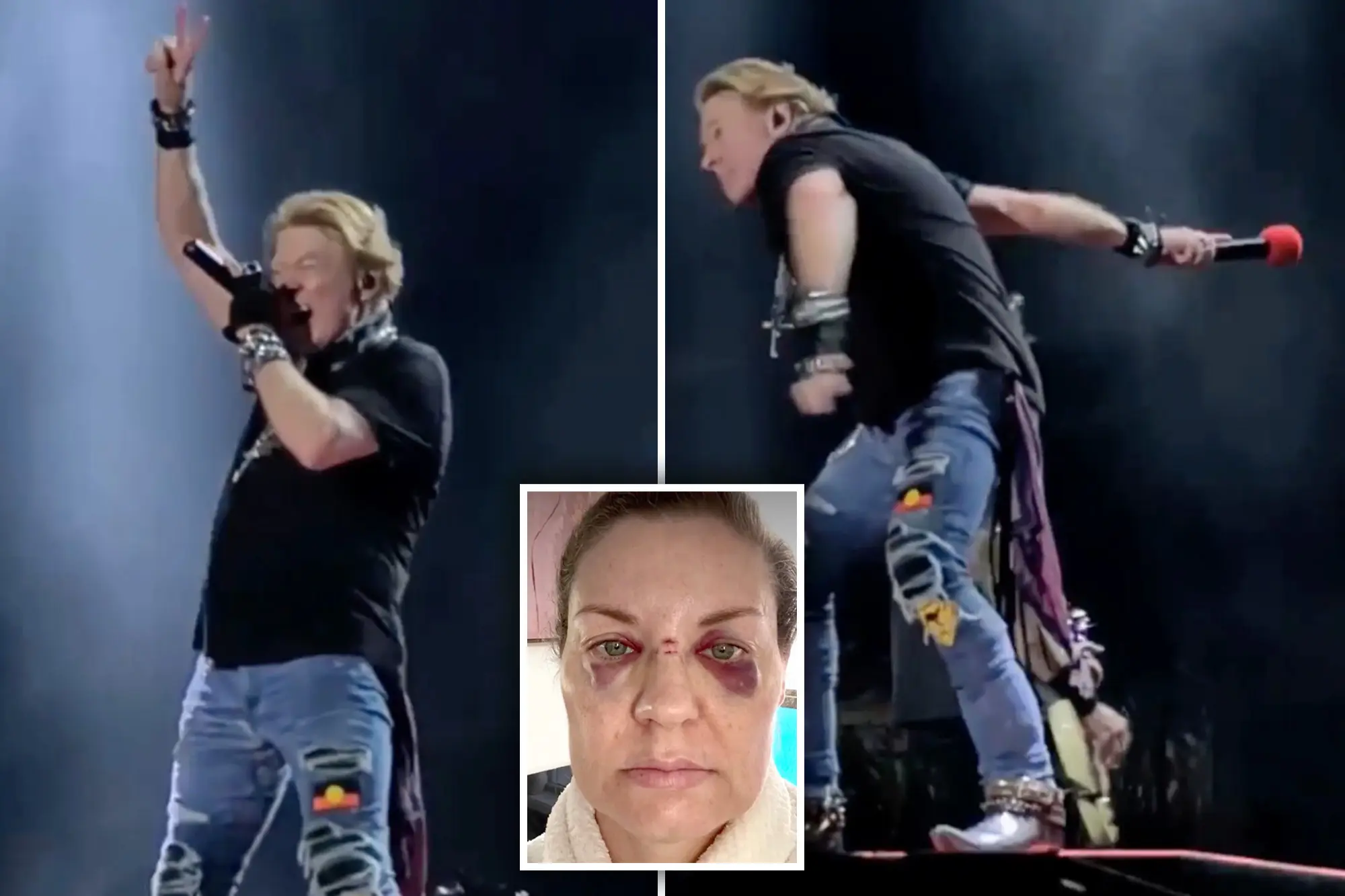 Adelaide Guns N Roses fan hit by microphone thrown by Axl